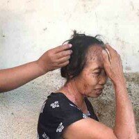Nenek pedagang sayur keliling disiram air keras oleh orang tak dikenal.
